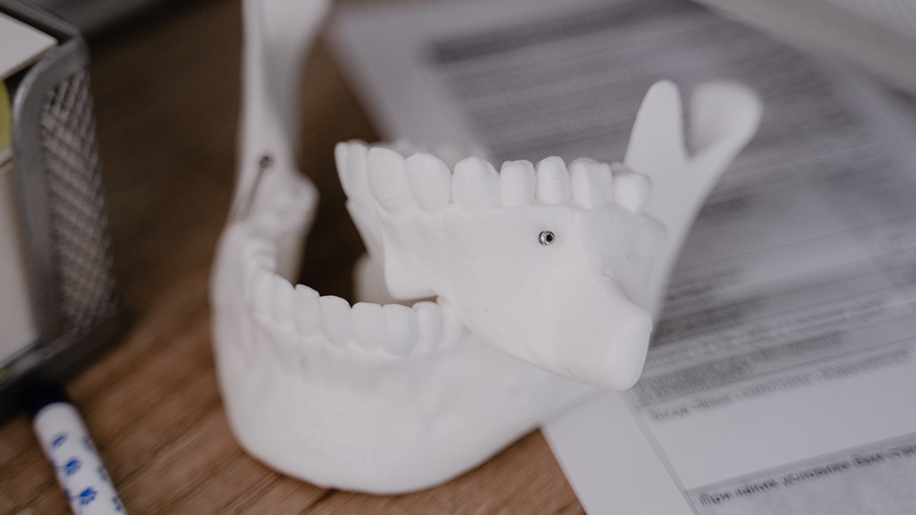 Interceptive Ortho
