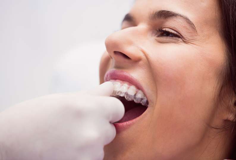 Importance of Milk Teeth