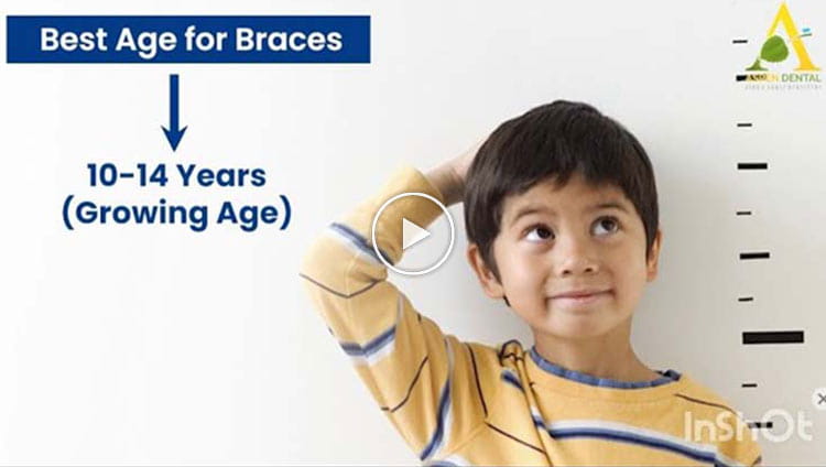 Can Braces/Invisalign be done at any age? Ideal age to visit orthodontist in Delhi?